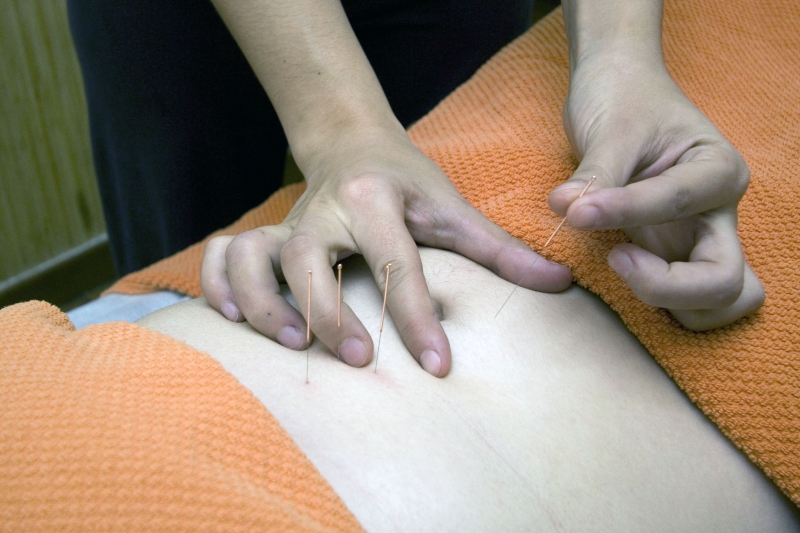 osteopathe-SANARY SUR MER-min_acupuncture-4175625